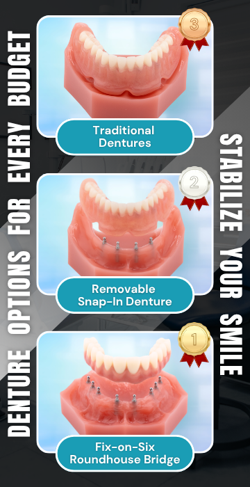 Implant Denture Options in Missoula, MT | Affordable Dentures