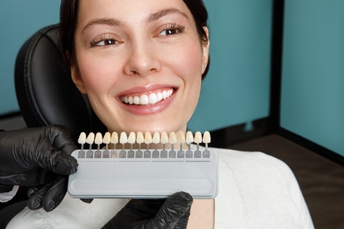 Teeth Whitening in Missoula, MT | Affordable Cosmetic Dentistry