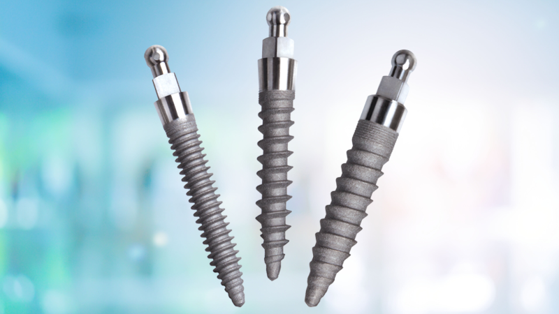 Dental Implants in Missoula, MN | Mini Implant Dentist Near Me