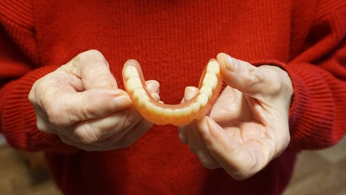 Older hands holding a flexible metal-free denture
